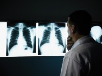 Private practice Radiology might be a thing of the past
